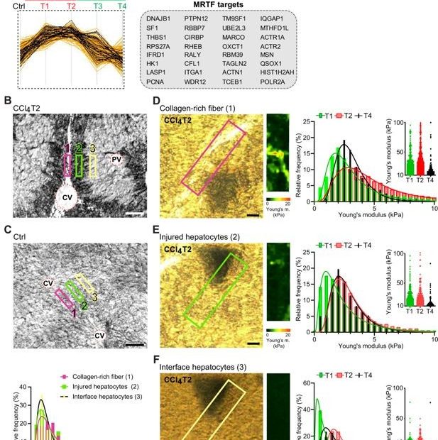 Atomic force microscopy (AFM) stiffness mapping reveals changes in the local mechanics of liver tissue upon hepatotoxic injury