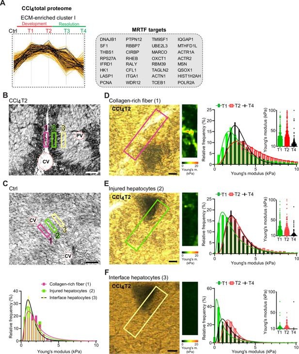Atomic force microscopy (AFM) stiffness mapping reveals changes in the local mechanics of liver tissue upon hepatotoxic injury.
